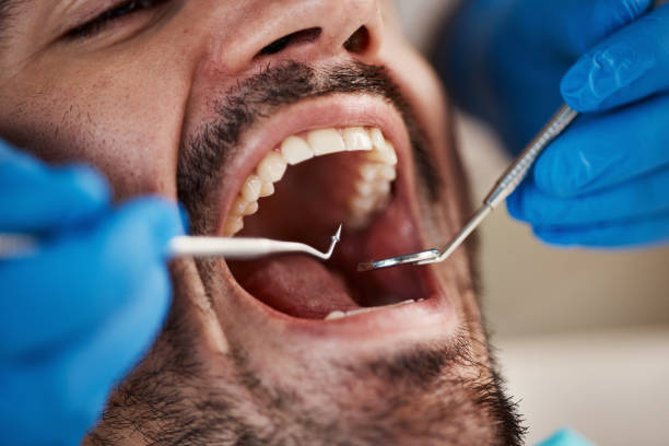 Best Emergency Tooth Extraction in Gueydan, LA